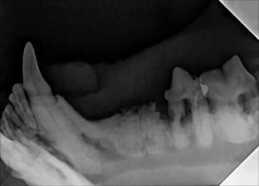 X-ray of a jaw and teeth