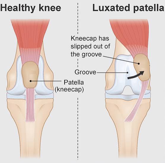 Comparison of healthy and luxated patella