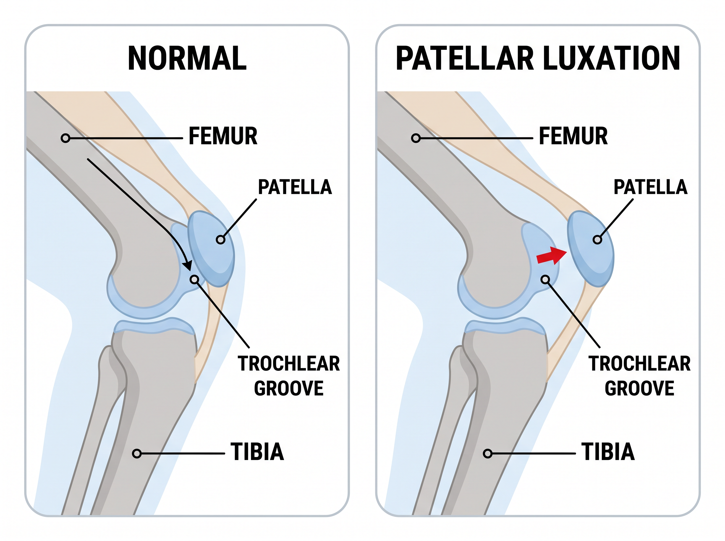Diagram comparing a normal dog knee, where the patella tracks in the trochlear groove, to a patellar luxation, where the patella is displaced to the inside of the groove
